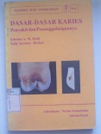 Image of Dasar-Dasar Karies : Penyakit  dan Penanggulangannya