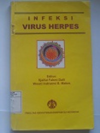 Image of Infeksi Virus Herpes