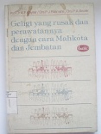Image of Geligi Yang Rusak dan Perawatannya dengan cara Mahkota dan Jembatan